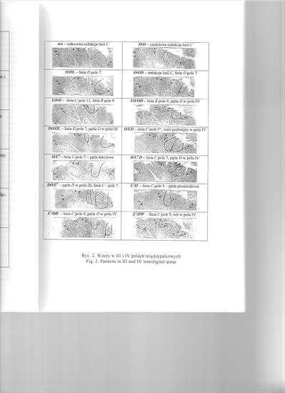 Buchwald Kompleksowa ocena asymetrii dermatoglifów - bScanImage004.jpg